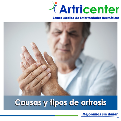 Artricenter: Causas y tipos de artrosis