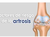 Artricenter: Factores riesgo artrosis
