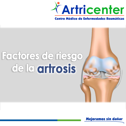 Artricenter: Factores de riesgo de la artrosis