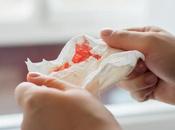 Hemorragia nasal durante embarazo