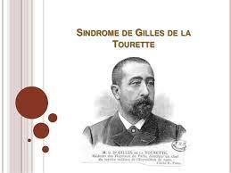 Sindrome de Gilles de la Tourette – Guia clínica (resumen) 2019