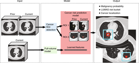 Predicción del riesgo de cáncer mejor con máquinas…