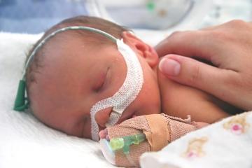 El bebé prematuro El bebé prematuro