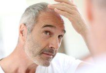 Causas y tratamientos del adelgazamiento del cabello Causas y tratamientos del adelgazamiento del cabello