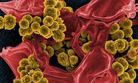 Los Celulares del Personal de Salud difunden Bacterias Patógenas
