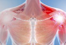 Dolor de deltoides ¡control y recuperación! Tras lesionar su deltoides se recomienda reposo, hielo y calor