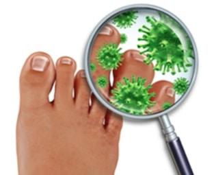 10 remedios para eliminar la onicomicosis (hongos en las uñas del pie) onicomicosis que es