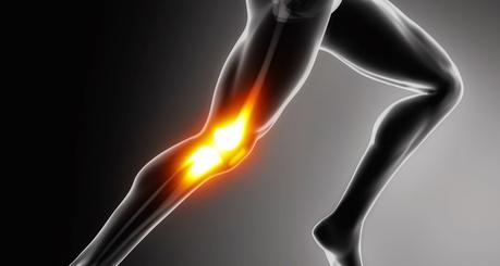 ¿Por qué razón se produce el dolor de rodillas?