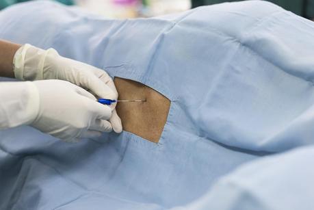 Tatuajes y piercing en el embarazo Tatuajes y piercing en el embarazo