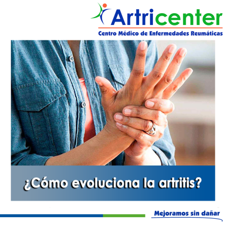 Artricenter: ¿Cómo evoluciona la artritis? Artricenter: ¿Cómo evoluciona la artritis?