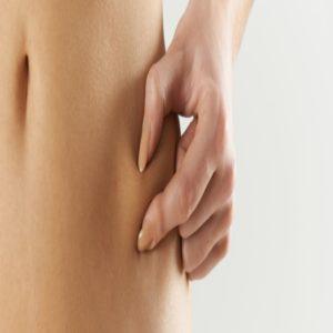 Coolsculpting: Cómo eliminar la grasa abdominal sin cirugía Coolsculpting: Cómo eliminar la grasa abdominal sin cirugía