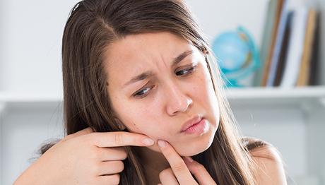 Remedios caseros para el acné hormonal