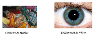 Tabla periódica y vida. Conceptos básicos de bioinorgánica