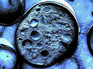 Angiogenesis con Celulas Madres para Diabeticos