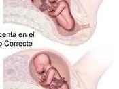 ¿Que placenta previa?