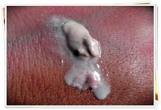 Todo sobre los iluminadores