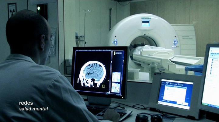 El azote del Alzheimer