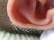 importancia limpiar oídos bebé