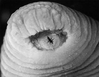 DESCUBREN NUEVO ANIMAL EN LA NARIZ DE UNA NIÑA