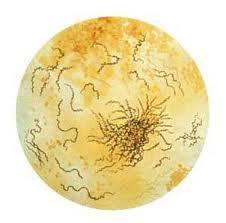 sifilis ¿Qué es la sífilis?