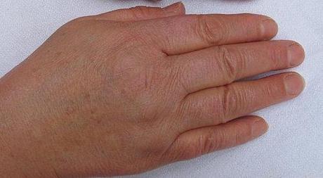 REPARADOR DE MANOS. ORIGEN Y PRIMERAS APLICACIONES DESPUÉS