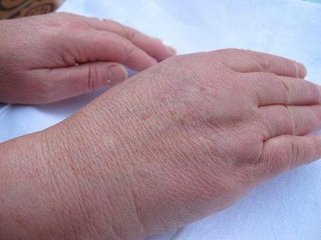 REPARADOR DE MANOS. ORIGEN Y PRIMERAS APLICACIONES ANTES