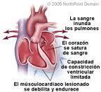 Evalúan el efecto de las dosis altas de furosemida en insuficiencia cardíaca Evalúan el efecto de las dosis altas de furosemida en insuficiencia cardíaca