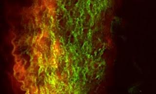 Un tinte verde para detectar la grasa acumulada en las arterias