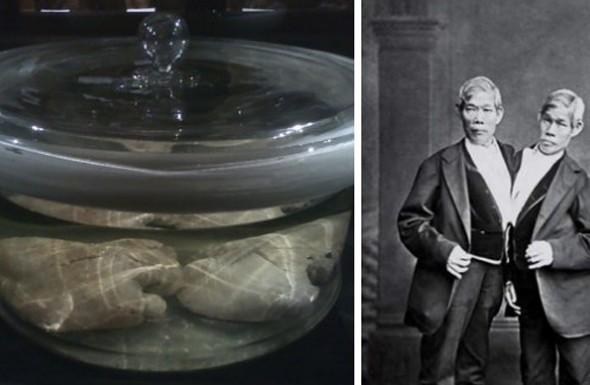 Ocho partes del cuerpo expuestas en raros lugares del mundo