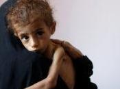 ¿Por nunca acaba hambre mundo?