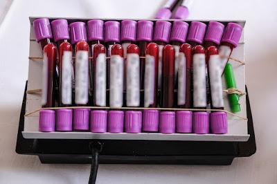 REALIZA ISEM 48 MIL PRUEBAS PARA DIAGNOSTICAR HEPATITIS B Y C