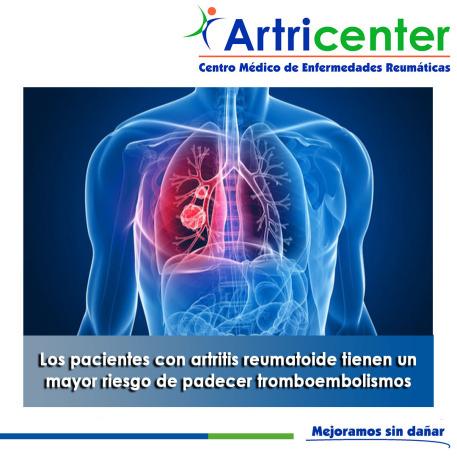 Artricenter: Los pacientes con artritis reumatoide tienen un mayor riesgo de padecer tromboembolismos Artricenter: Los pacientes con artritis reumatoide tienen un mayor riesgo de padecer tromboembolismos