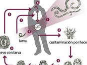 Ascariasis (Ascaris lumbricoides)