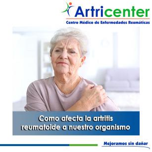 Artricenter: Como afecta la artritis reumatoide a nuestro organismo