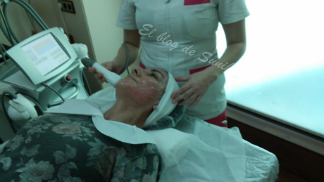 Tratamiento en Elite Laser Tratamiento en Elite Laser