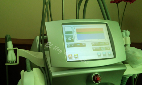 tratamiento de radifrecuencia tratamiento de radifrecuencia