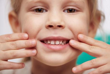 Accidentes y rotura de dientes en la infancia
