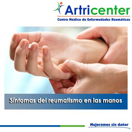 Artricenter: Síntomas del reumatismo en las manos