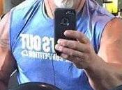 Goldberg regresar pero sube foto sangre