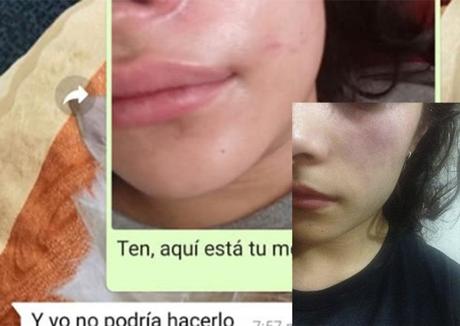 Joven potosina denuncia a su ex por maltrato y amenazas de muerte