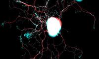 Descubren como regenerar las células nerviosas dañadas Descubren como regenerar las células nerviosas dañadas