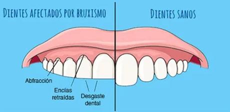 ¿Sueles morderte la parte interna de las mejillas?
