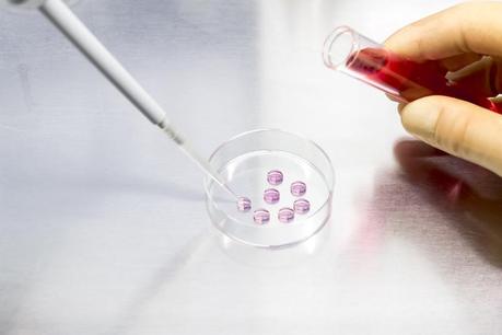 ¿Hay que hacer reposo después de una inseminación o de un tratamiento de Fertilización in Vitro? ¿Hay que hacer reposo después de una inseminación o de un tratamiento de Fertilización in Vitro?
