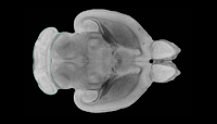 Científicos revierten el proceso de envejecimiento del cerebro