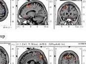 personas trastorno límite personalidad activan regiones cerebrales distintas para controlar impulsos