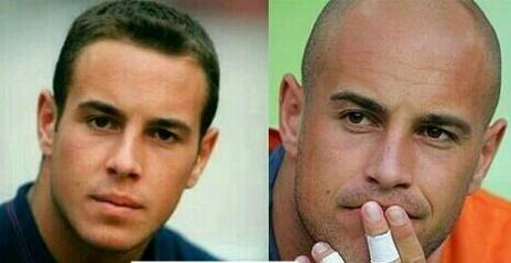 Aunque parezca mentira, Pepe Reina tuvo pelo. 