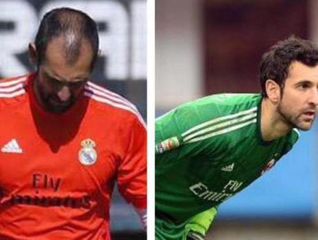 jugadores que recuperaron el pelo 