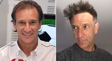 futbolistas que recuperaron el pelo 