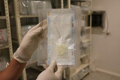 APOYA BANCO DE TEJIDOS CON MÁS DE 4 MIL 800 COMPUESTOS PARA TRATAMIENTOS Y CIRUGÍAS DE ESPECIALIDAD