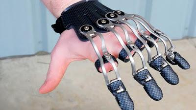 Impresión 3D de implantes y prótesis: estado del arte Impresión 3D de implantes y prótesis: estado del arte